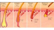 Electrolysis